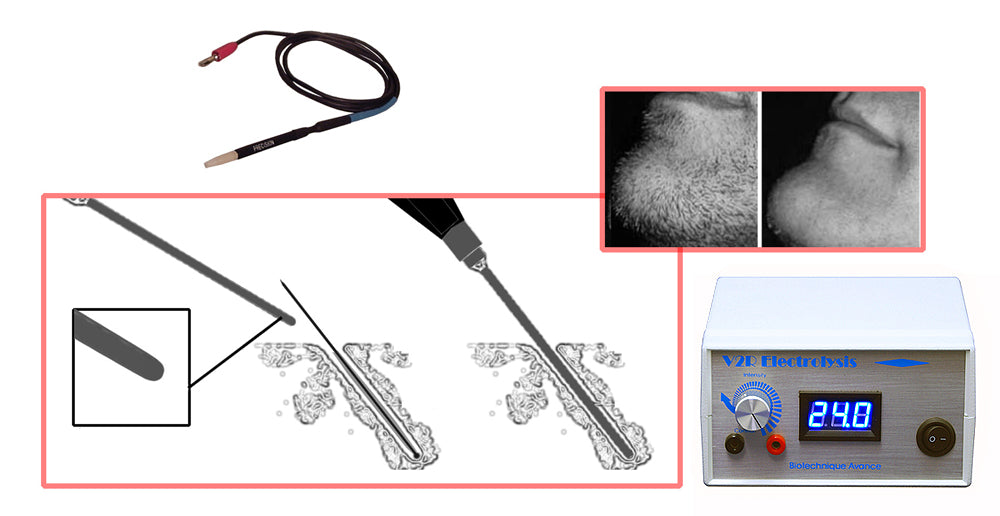 V2R Salon Medispa Electrolysis Machine Permanent Body & Facial Hair Re