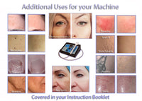 IPL850LS Professional Intense Pulsed Light Wrinkle Reduction & Skin Toning System +>