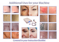 Hyper Pigmentation Laser Machine Home Clinic Salon System age spot removal