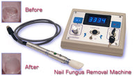 Nail treatment laser, home equipment for finger nail & toenail fungus