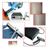 SDL60-EC-DX Permanent Laser Hair, Wrinkle, Tattoo Removal Laser NonIPL System Machine Device