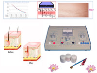 Système professionnel d'épilation permanente, machine de traitement sans laser et kit de gel de microlyse.