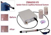 Dispositivo para remoção de tratamento de veias varicosas e aranhas