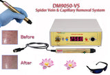 Spider & varicose vein treatment removal system for legs, face, nose, best for women & men