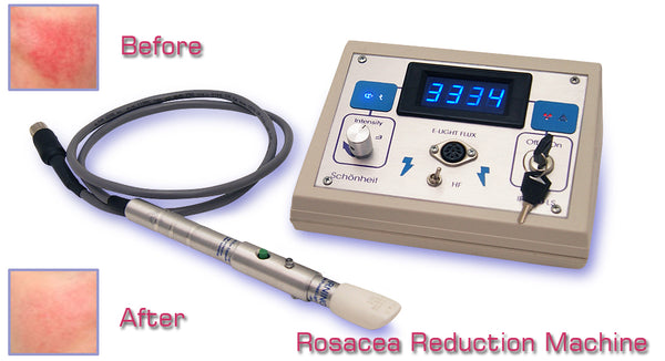 IPL350 Rosacea treatment device for at home clinic salon treatments, best results quality machine.