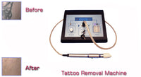 IPL750 Portable tattoo removal machine, best salon or home use system with aesthetic cream.